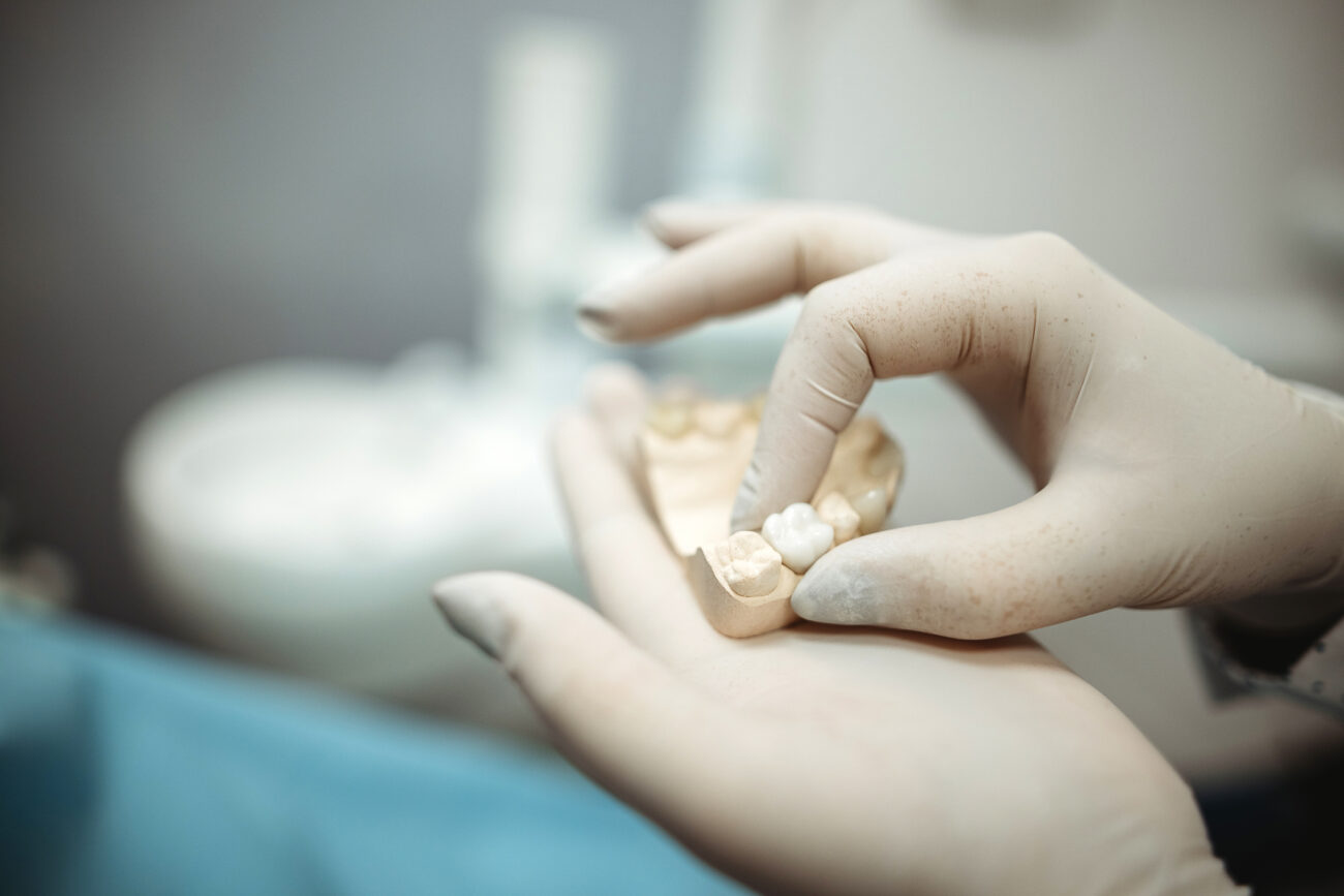 Dental Crowns in Tampa, Florida