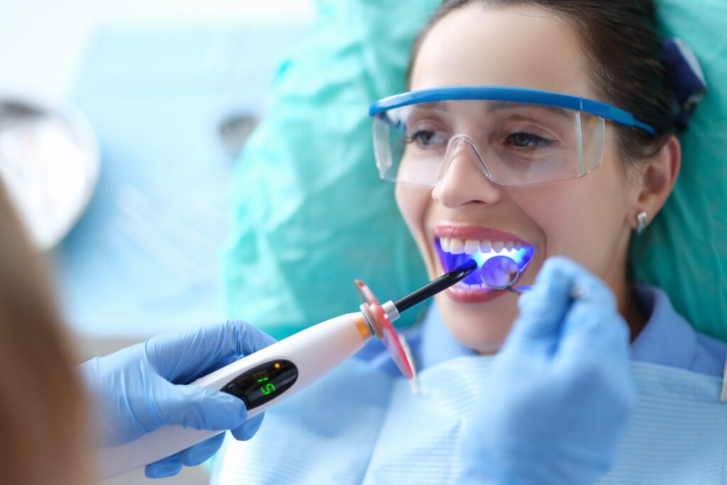 Dental Bonding in Tampa, Florida