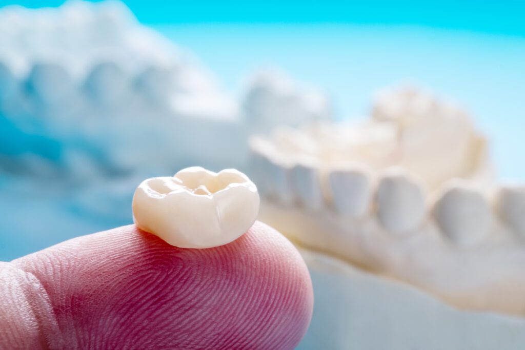 Are Dental Crowns Right For Me?