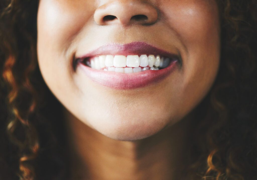 Will Insurance Cover Cosmetic Dentistry?