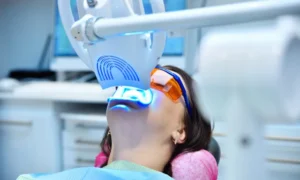 Teeth Whitening: Professional vs. OTC in South Tampa, FL